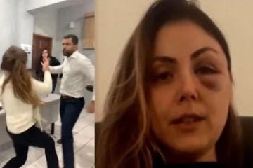 O procurador Demétrius Oliveira de Macedo agrediu a procuradora-geral do município Gabriela Samadello Monteiro de Barros.