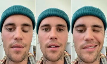 O cantor Justin Bieber publicou um vídeo no Instagram em que falou sobre o diagnóstico da síndrome de Ramsay.